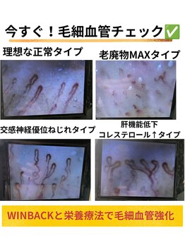 ポノ(pono)/毛細血管チェック！