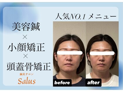 サルース(Salus)の写真