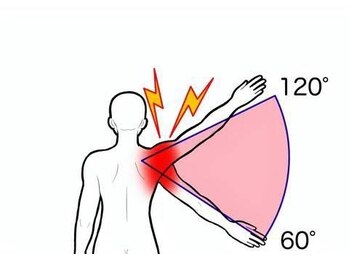 ストレッチプロ 新市街店(STRETCH PRO)/痛くて上がらない肩のお悩みに