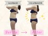 Rサイズ【脂肪冷却】浮き輪肉撃退！お腹まわりor腰回り2ヶ所★25600→19600