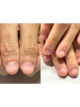 爪の悩みを解消できる（ケア含む）