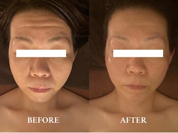 頭蓋骨 小顔矯正サロン グレースフィオーレ 札幌店(gracefiore)/ビフォーアフター