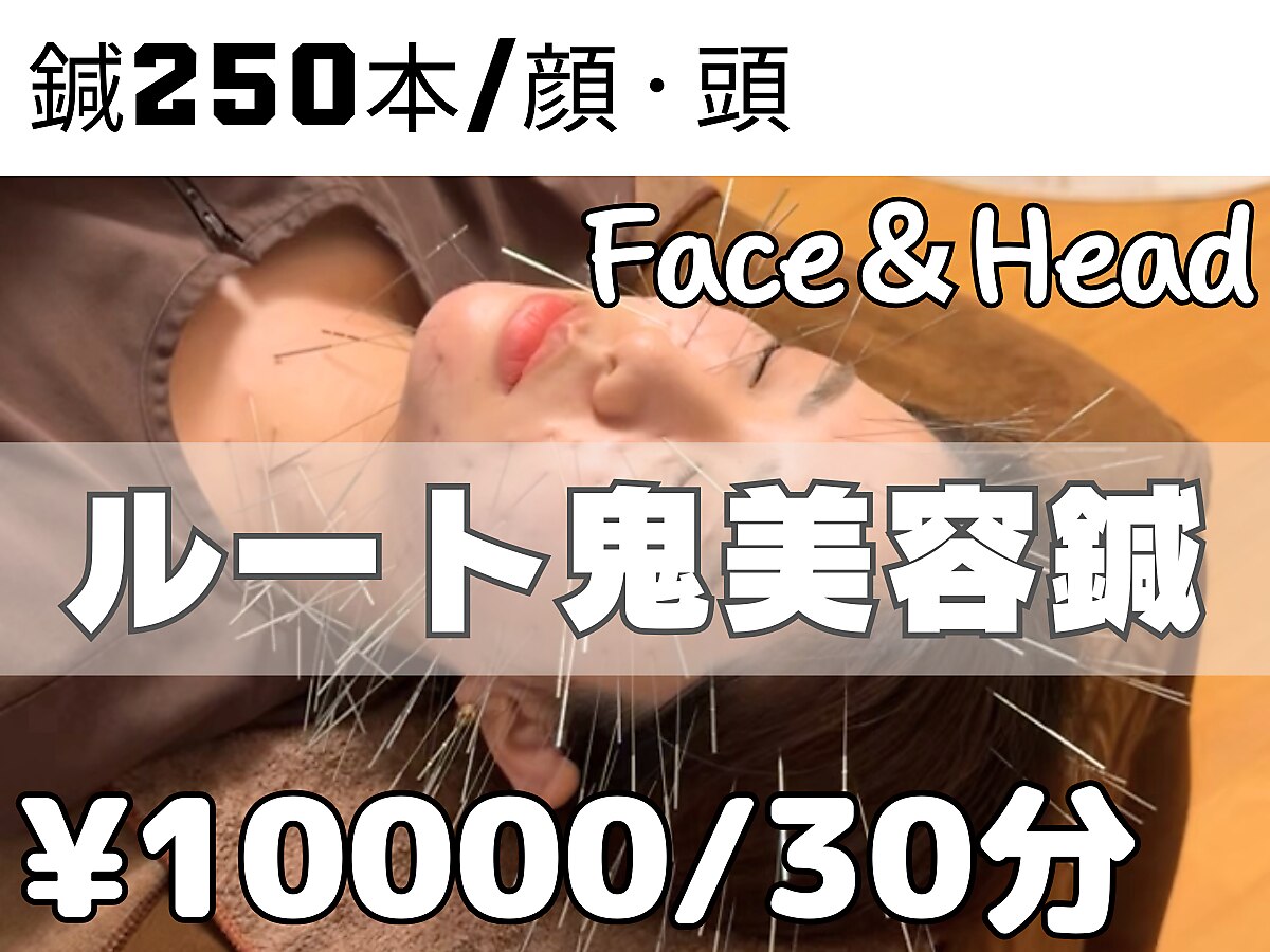 鬼美容鍼☆ルート鍼【30分コース】顔、頭メイン