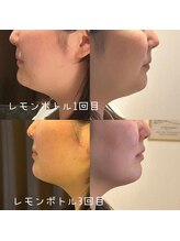 サロン ド モミカル(salon de momikaru)/レモンボトル