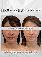 サロン ド ナース ユー ソナ(salon de nurse U.sona)/トーンアップや引き締め効果も！