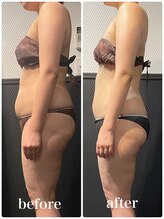 ピーラトゥ 日立(P-Ratu)/ブライダルコース