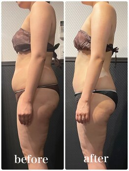 ピーラトゥ 日立(P-Ratu)/ブライダルコース