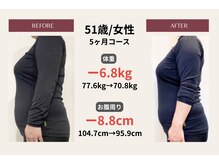 ピアリーノ(Pialino)/