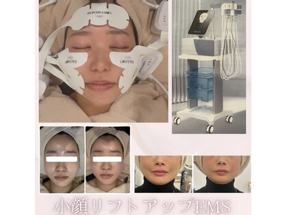 リボディ プラチナ(Rebody platinum)の写真