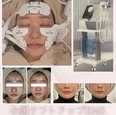 リボディ プラチナ(Rebody platinum)