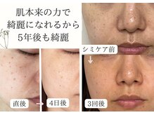 シフォン(Chiffon)の雰囲気(お肌悩みがある方はぜひ効果を体感して素肌に自信を持ちましょう)