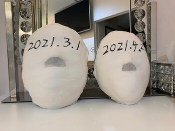 R-1ビューティーサロン 表参道/Before &After(3回)