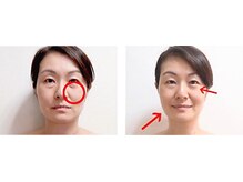 アクア エステティコ 亀有(ACQUA estetico)/小顔リフトUP エイジングケア