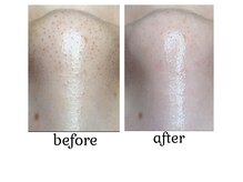 ラディア(Radia)/