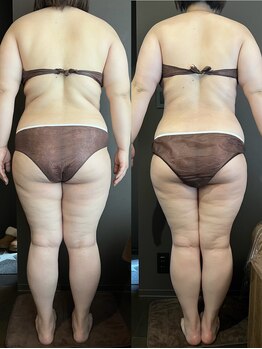 ステラ(Stella)/凄い変化＼(^-^)／