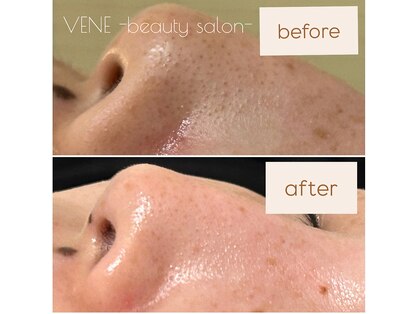 ウェヌ(VENE)の写真