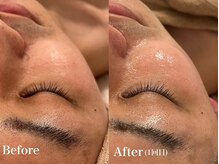 シャルム(Charme)/メンズフェイシャル♪毛穴ケア