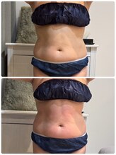 ヒール スパ(heal spa)/天然由来！メリハリBODY★