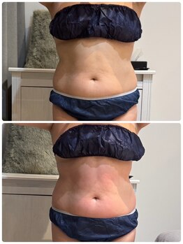 ヒール スパ(heal spa)/天然由来！メリハリBODY★