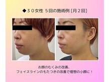 やれば変わる！！マスク生活によるたるみを改善！