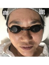 ルーチェ(Luce)/光フェイシャル！