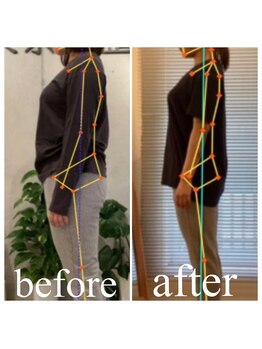 東京G整体/ダイエットビフォーアフター