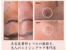 アールヨンマルハチ フェイスアンドアイ(R408.face&eye)の雰囲気（リピーター続出＼人気No．１メニュー／シミケア放題×肌質改善）