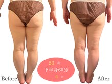 アルピナ(ALPINA)/ウルトランスフォーマー