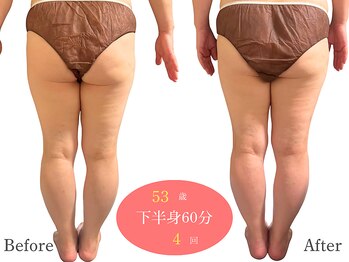 アルピナ(ALPINA)/ウルトランスフォーマー