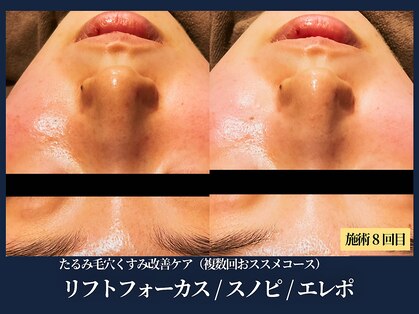 エヴァーグレース 栄店の写真