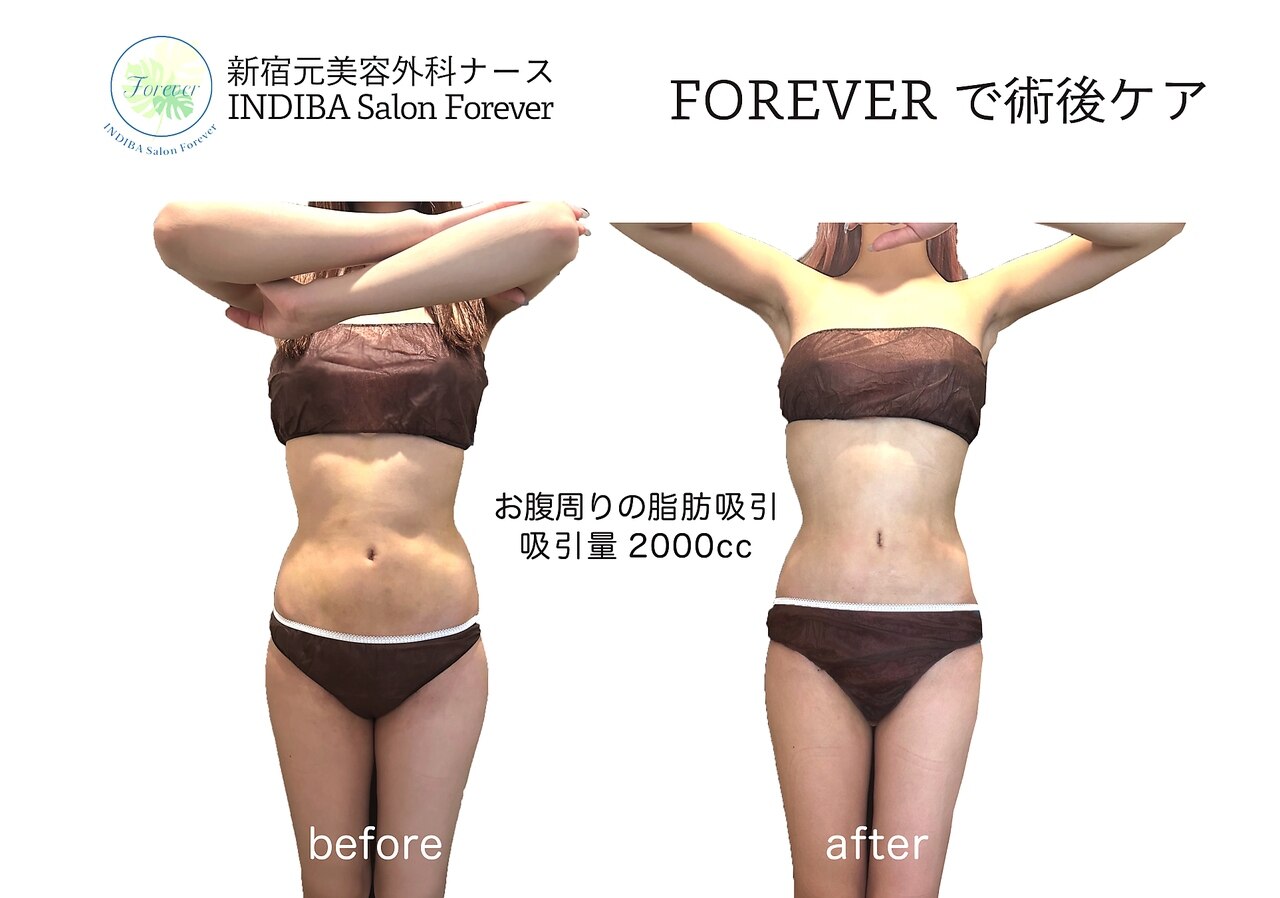 インディバ サロン フォーエバー(Forever)｜ホットペッパービューティー