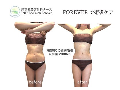 インディバ サロン フォーエバー(Forever)の写真