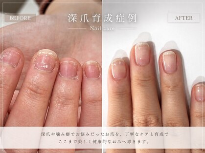 爪家の写真