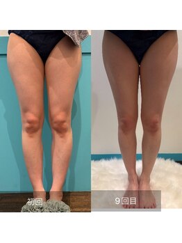 カーラ(cara)/下半身モニターのお客様
