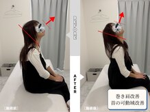 整体リライン 生駒院(整体Re:Line)/巻き肩改善