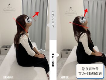 整体リライン 生駒院(整体Re:Line)/巻き肩改善