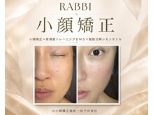 ラビ(RABBI)