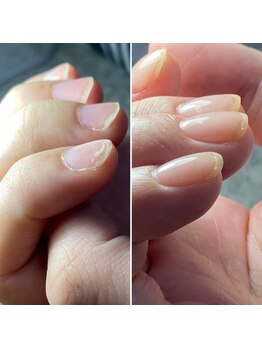 爪の悩みを解消できる（ケア含む）