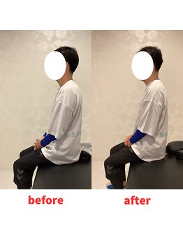 ナオル整体 福岡香椎院(NAORU整体)/40代男性施術事例【猫背】