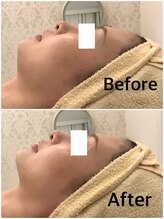 スペチアーレ 夙川/横顔も更に美しく