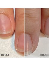 ココデネイル(cocode nail)/継続ケアで美爪キープ♪