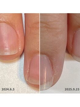 ココデネイル(cocode nail)/継続ケアで美爪キープ♪