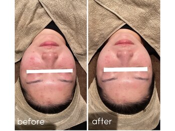 サロン リア(Salon Li’a)/美肌サポートケア☆