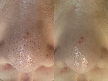 サイセイ(SAISEI)/