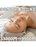 【人気NO.2】毛穴ニキビ業界初話題のシミケア ×お悩み別光フォト33000→9900
