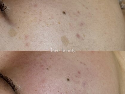 リコ ヘアアンドリラクゼーション(LICO)の写真