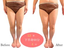 アルピナ(ALPINA)/ウルトランスフォーマー