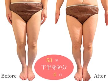 アルピナ(ALPINA)/ウルトランスフォーマー