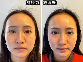 アオヤマ サロン ワイゼット(AOYAMA SALON YZ)/左右差すっきり