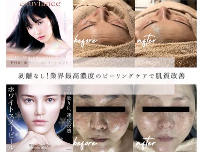 ソアム(Soame)の写真